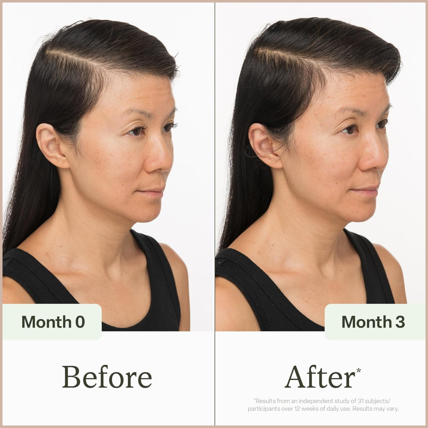 Scalp Health Serum – Hair Density & Fullness Support for Thinning Hair
