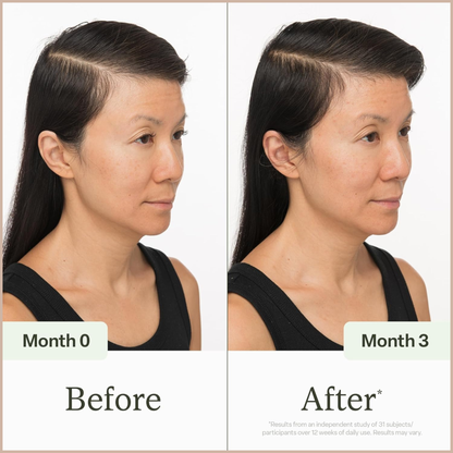 Scalp Health Serum – Hair Density & Fullness Support for Thinning Hair